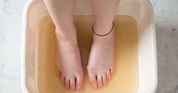 bagno allo iodio per trattare i funghi delle unghie