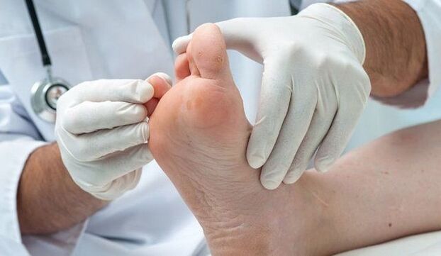 trattamento e diagnosi del fungo da parte di un medico