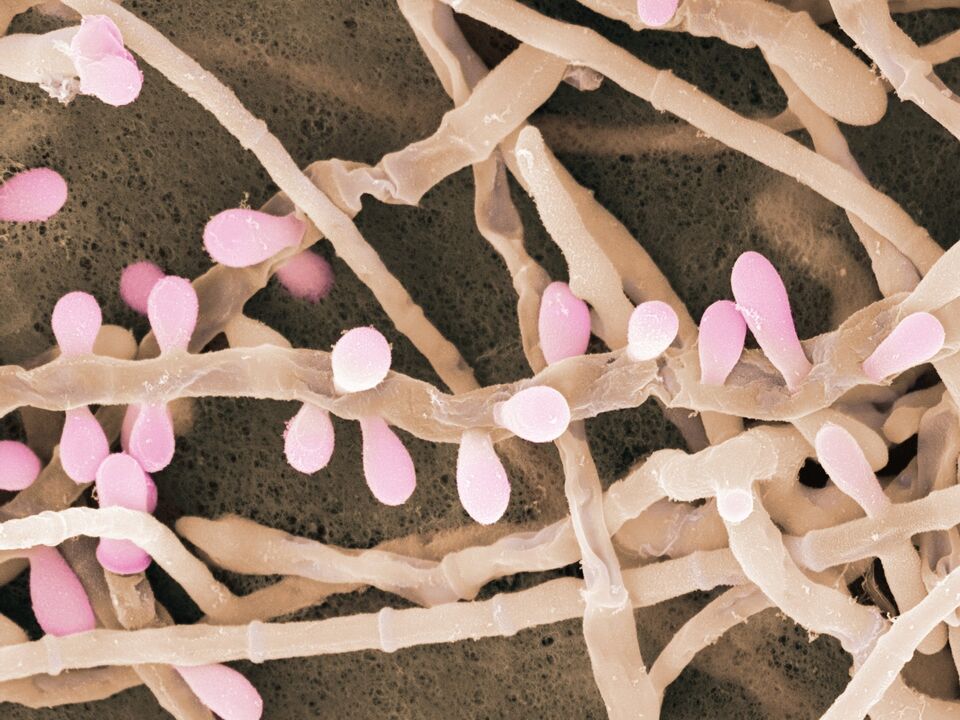 Il Trichophyton rubrum è un tipo di fungo che colpisce la pelle dei piedi.